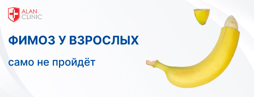 Фимоз у взрослых: само не пройдет