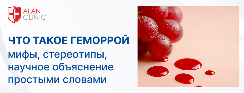 Что такое геморрой: мифы, стереотипы и научное объяснение